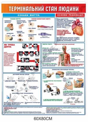 Стенд медичний “Термінальний стан людини”