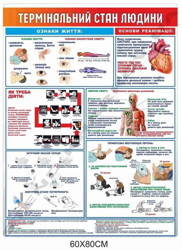 Стенд медичний “Термінальний стан людини”