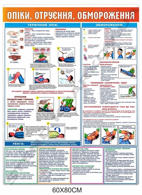 Стенд “Опіки, отруєння, обмороження”
