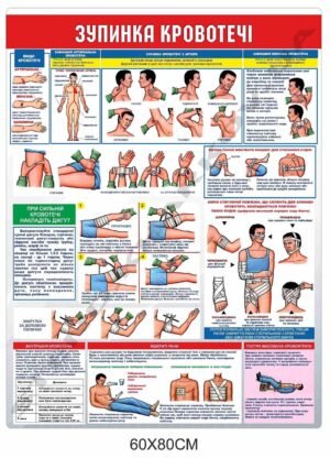 Медичний стенд “Зупинка кровотечі”