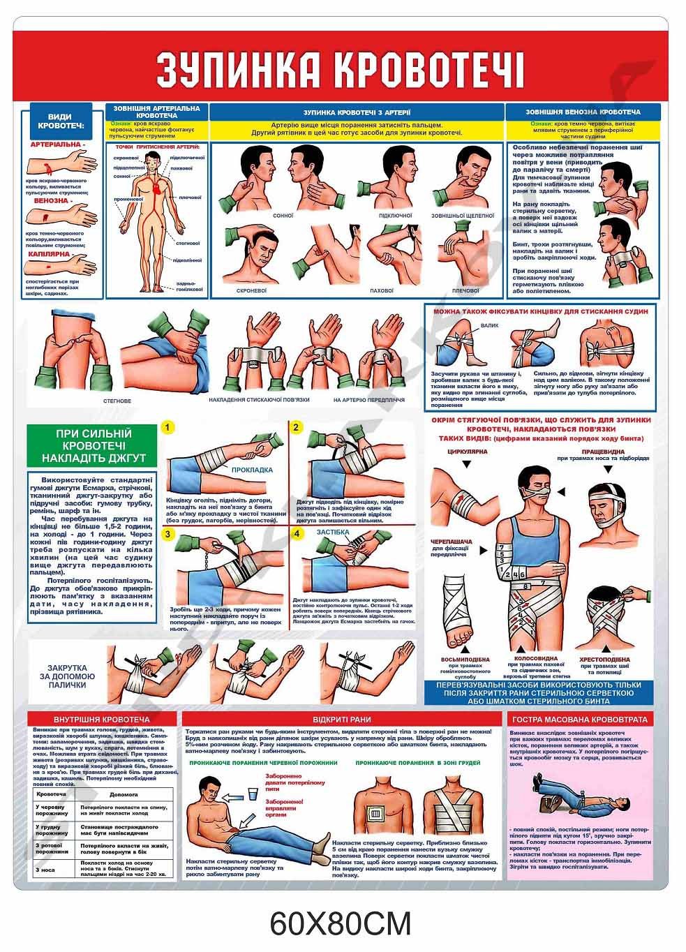 Медичний стенд "Зупинка кровотечі"